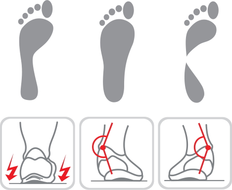 pronatietype hardloopschoen